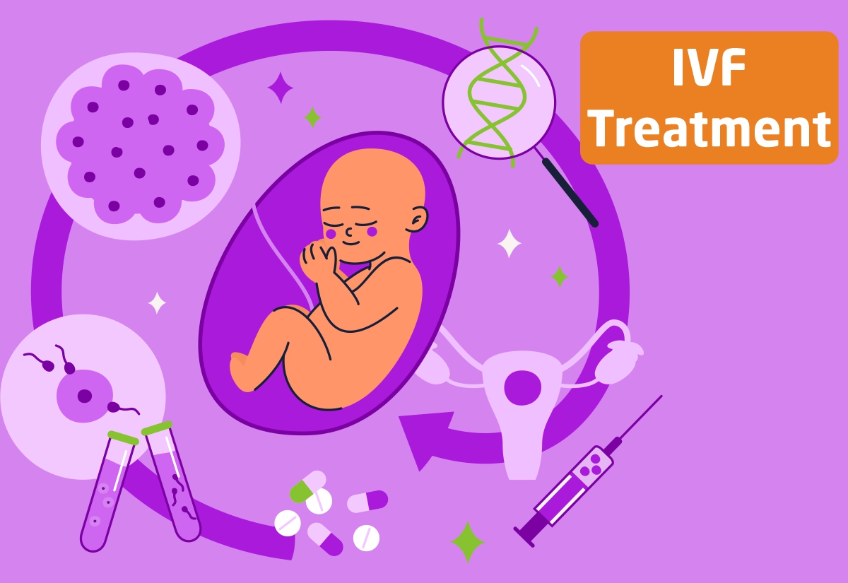 Ivf Procedure