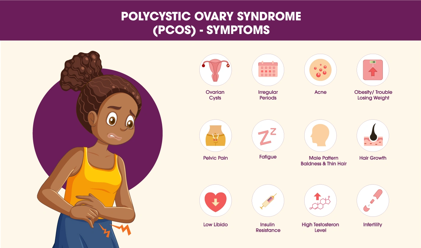 PCOS (Polycystic Ovary Syndrome) symptoms illustration, showing irregular periods, weight gain, acne, excess hair growth, fatigue, pelvic pain, infertility, insulin resistance, obesity, low libido and high testosterones.